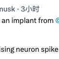 baidu09马斯克：全球首位人类已接受 Neuralink 脑机芯片植入手术，患者恢复良好