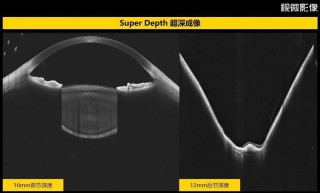 baidu09视微影像完成超 3 亿元 C 轮融资，加速打造世界级高端眼科器械平台型公司