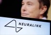 baidu09马斯克旗下脑机接口公司 Neuralink 获准在加拿大启动首个临床试验