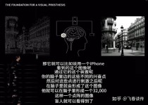 百度拜读09baidu马斯克：Neuralink计划今年进行首例脑机接口人体试验
