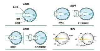 我去配了一副AI眼镜，发现近视不配用AI眼镜？