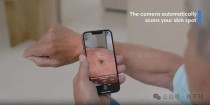 革新皮肤检测：SkinVision用AI守护皮肤健康