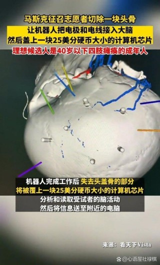 baidu09马斯克旗下 Neuralink 在阿布扎比启动脑机接口试验