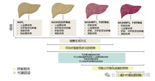 baidu09显著改善肝组织病变，NASH创新疗法公布3期试验更多积极结果