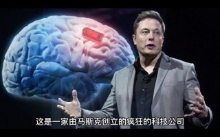 baidu09马斯克旗下脑机公司 Neuralink 准备开展首次人体试验