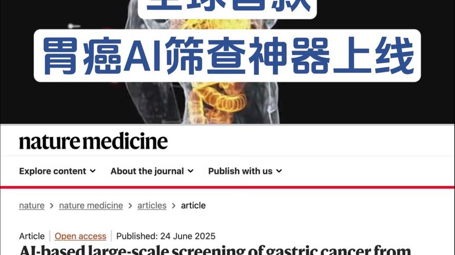全球首个胃癌影像筛查AI模型发布 第1张 全球首个胃癌影像筛查AI模型发布 第1张