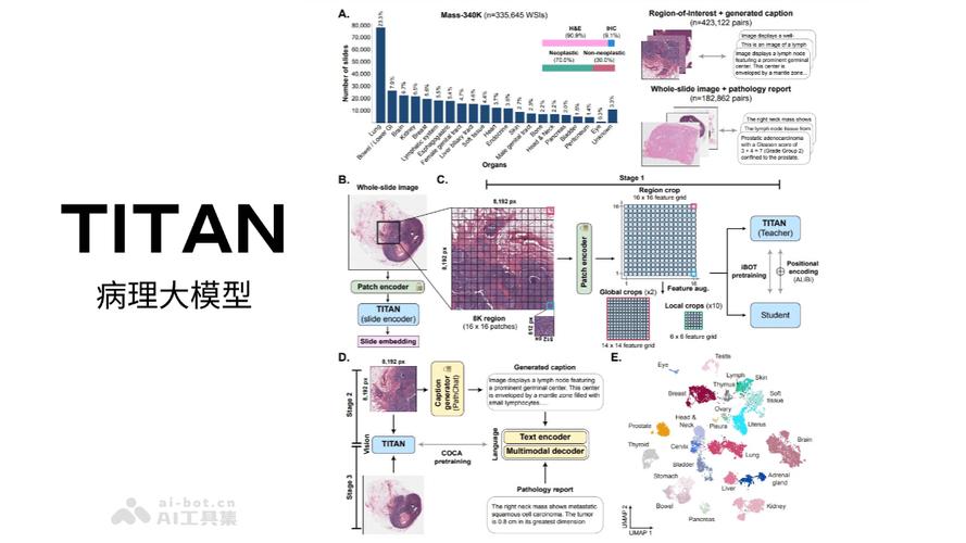 TITAN – 哈佛医学院研究推出的多模态全切片病理基础模型 第1张 TITAN – 哈佛医学院研究推出的多模态全切片病理基础模型 第1张