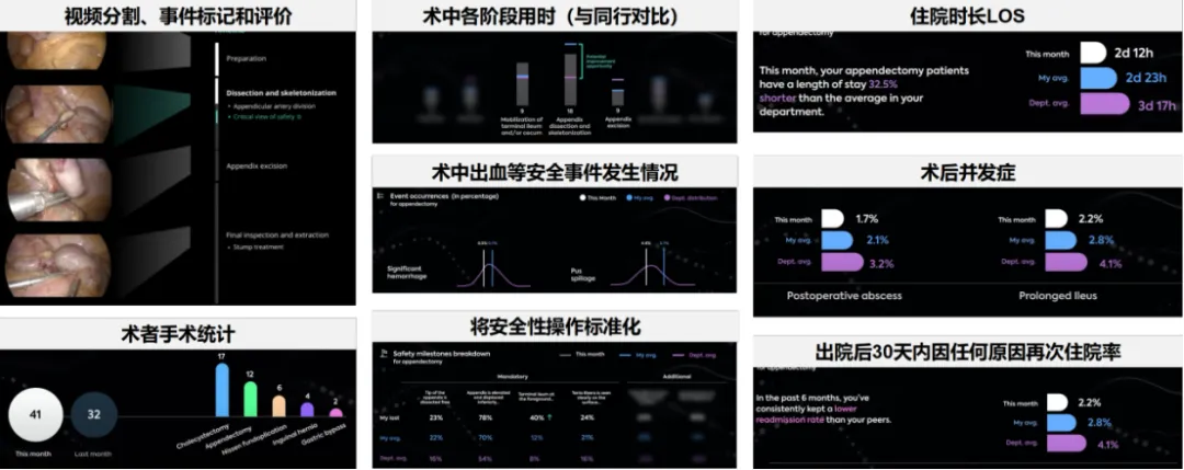 AI技术在微创外科中的应用和思考  第11张