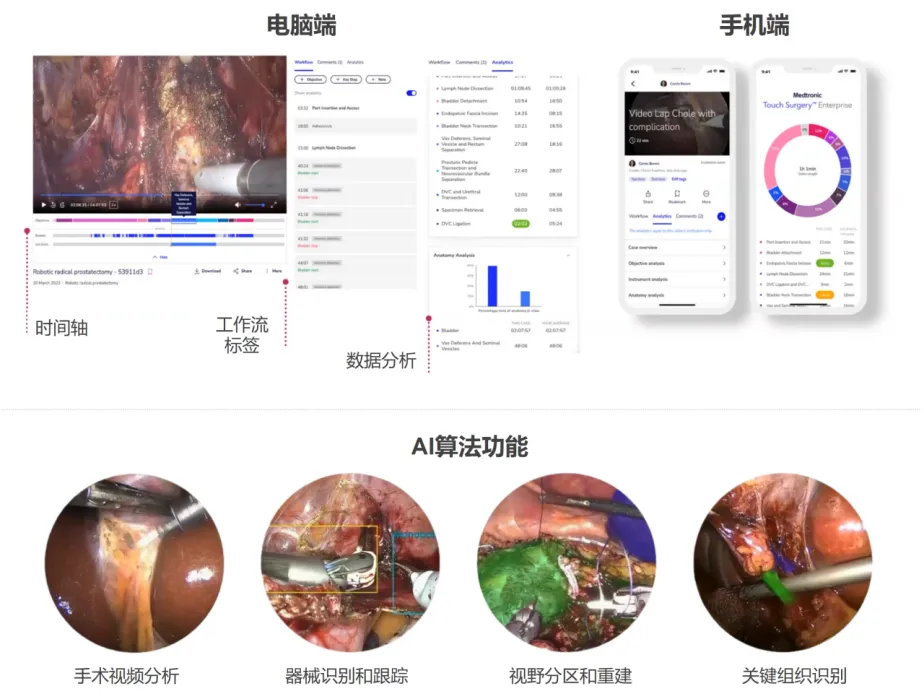 AI技术在微创外科中的应用和思考  第15张