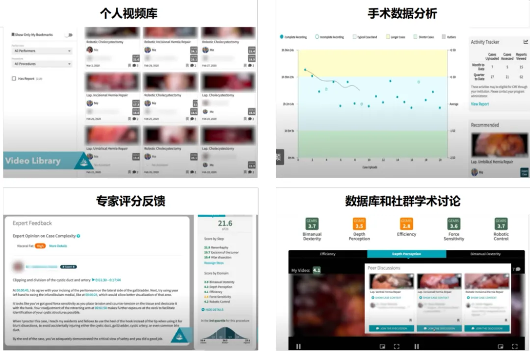 AI技术在微创外科中的应用和思考  第19张