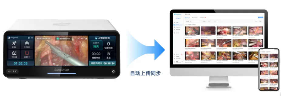 AI技术在微创外科中的应用和思考  第24张