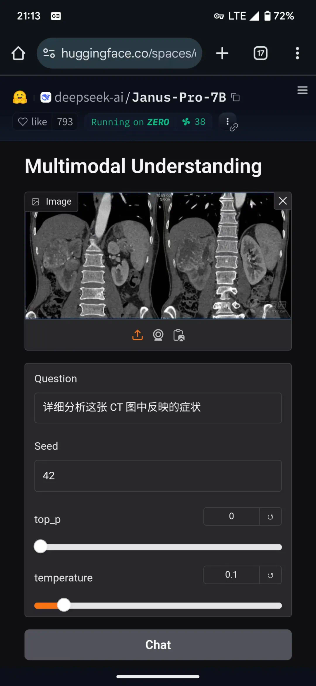 Deepseek多模态大模型Janus-Pro-7B在医疗领域的简单应用可行性测试  第1张