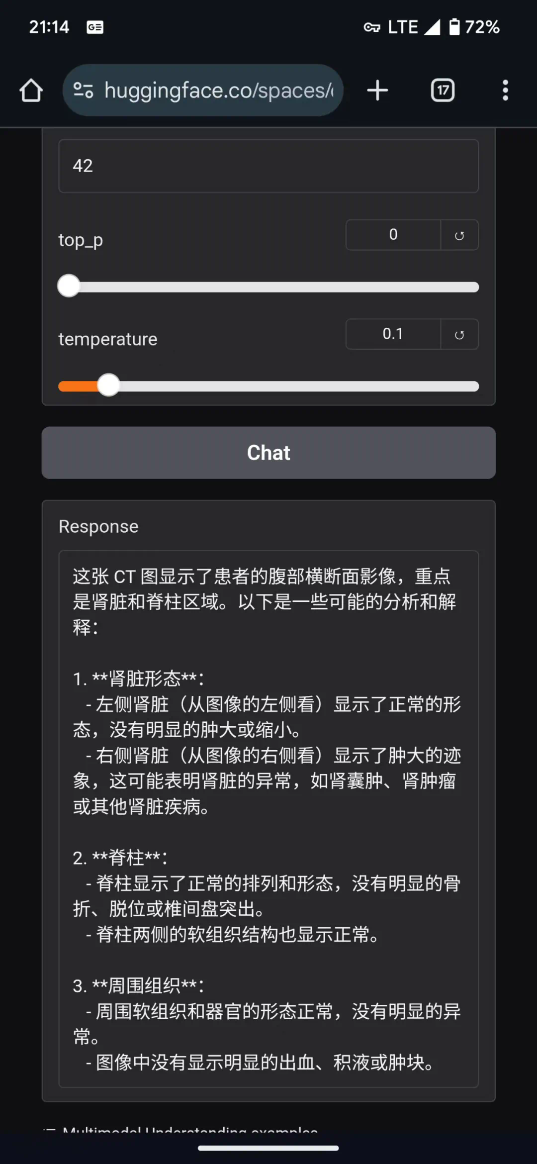 Deepseek多模态大模型Janus-Pro-7B在医疗领域的简单应用可行性测试  第2张