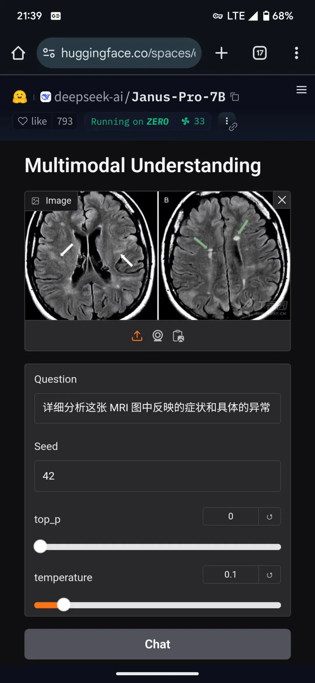 Deepseek多模态大模型Janus-Pro-7B在医疗领域的简单应用可行性测试  第5张