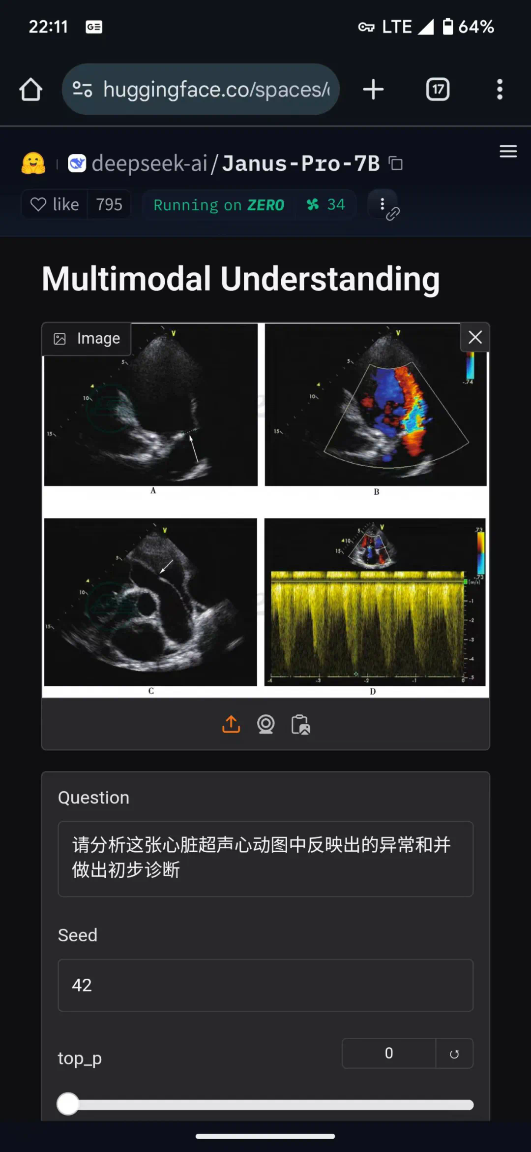 Deepseek多模态大模型Janus-Pro-7B在医疗领域的简单应用可行性测试  第7张