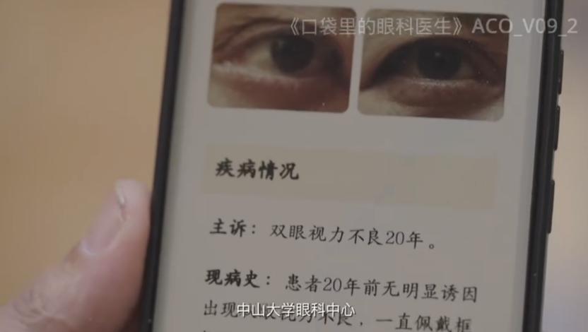 大规模筛查一周「看病」三千人，AI眼科大模型讲出了新故事  第2张