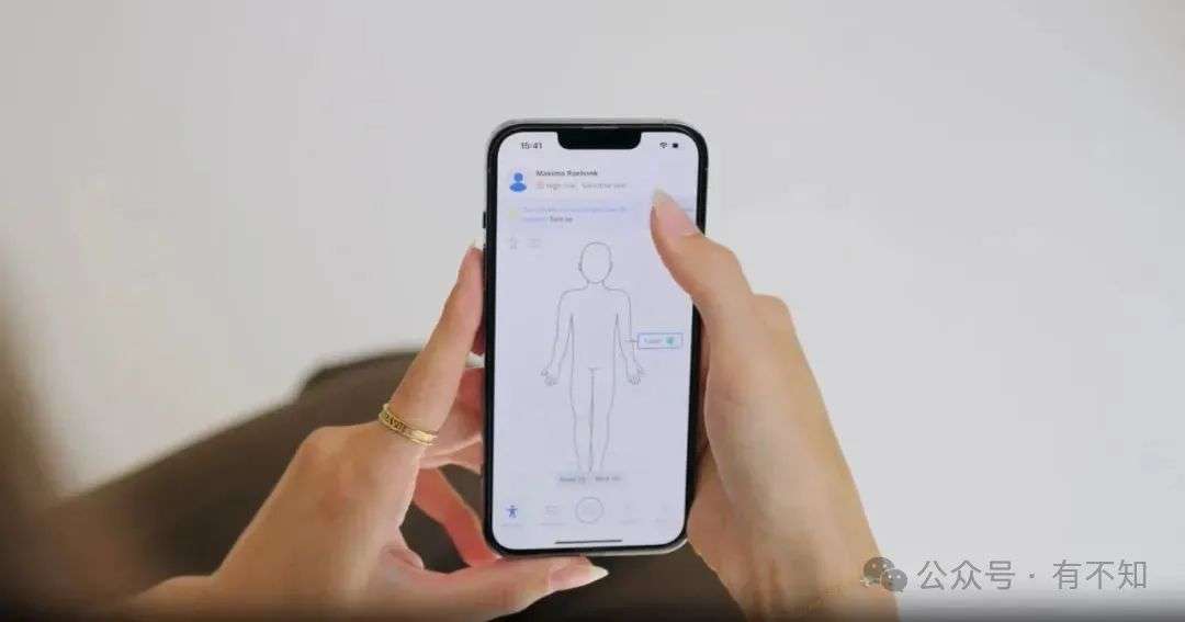 革新皮肤检测：SkinVision用AI守护皮肤健康  第2张