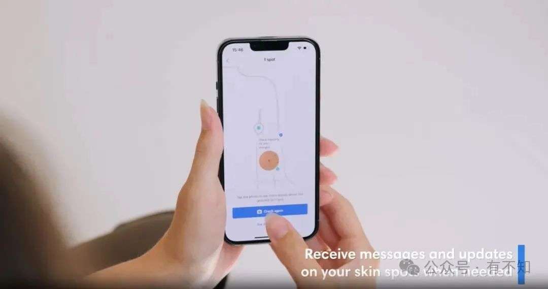 革新皮肤检测：SkinVision用AI守护皮肤健康  第3张