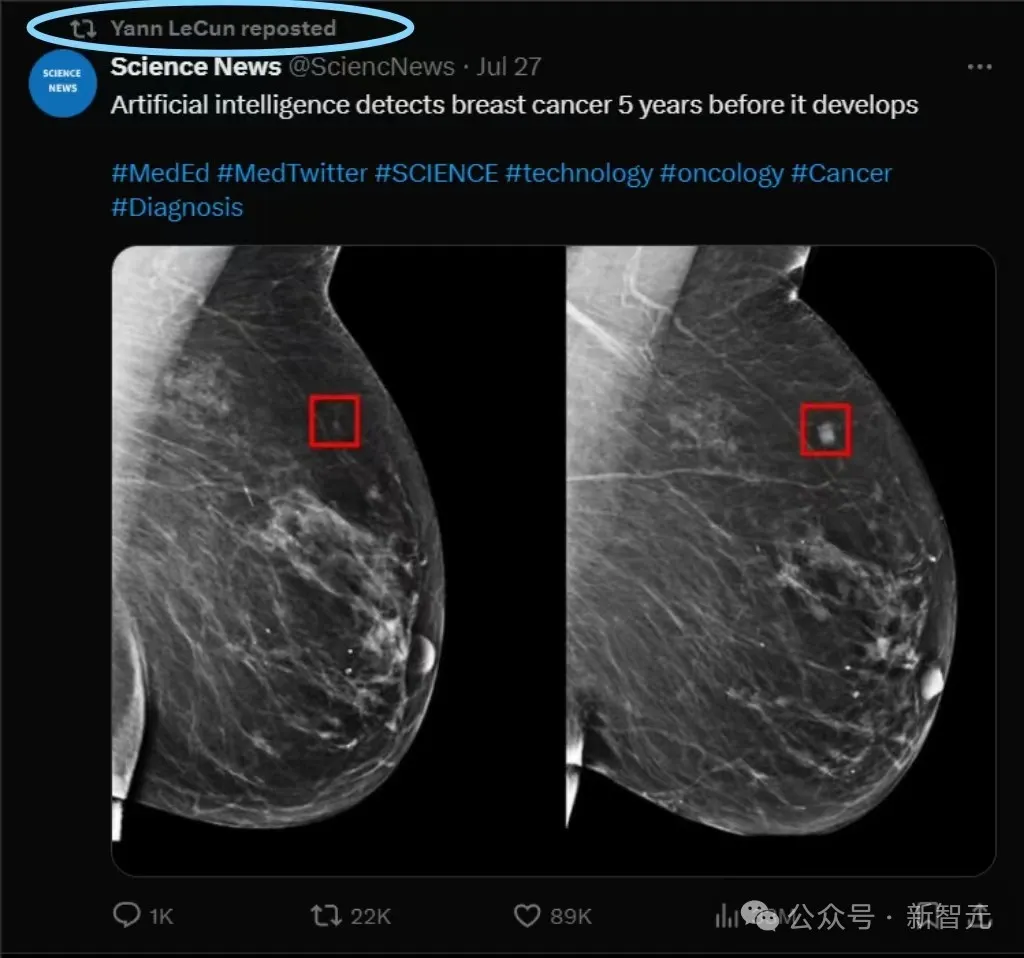AI模型提早5年预警乳腺癌，MIT研究登Science获LeCun转发  第2张