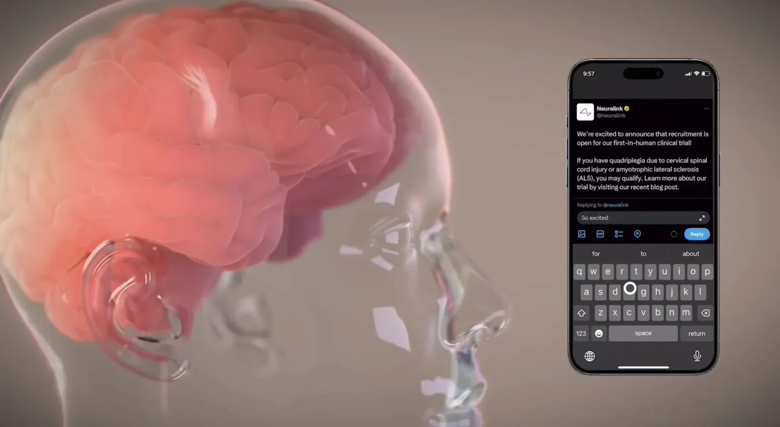 baidu09Neuralink：首位患者芯片植入物的细线现已稳定