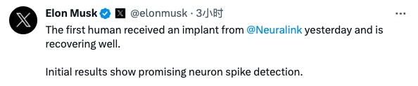 百度拜读09baidu马斯克：全球首位人类已接受 Neuralink 脑机芯片植入手术，患者恢复良好  第1张