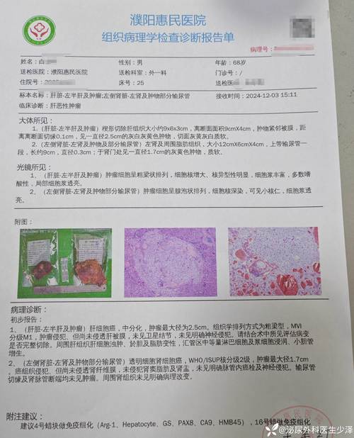 百度拜读09baidu显著改善肝组织病变,NASH创新疗法公布3期试验更多积极结果 第1张 百度拜读09baidu显著改善肝组织病变,NASH创新疗法公布3期试验更多积极结果 第1张